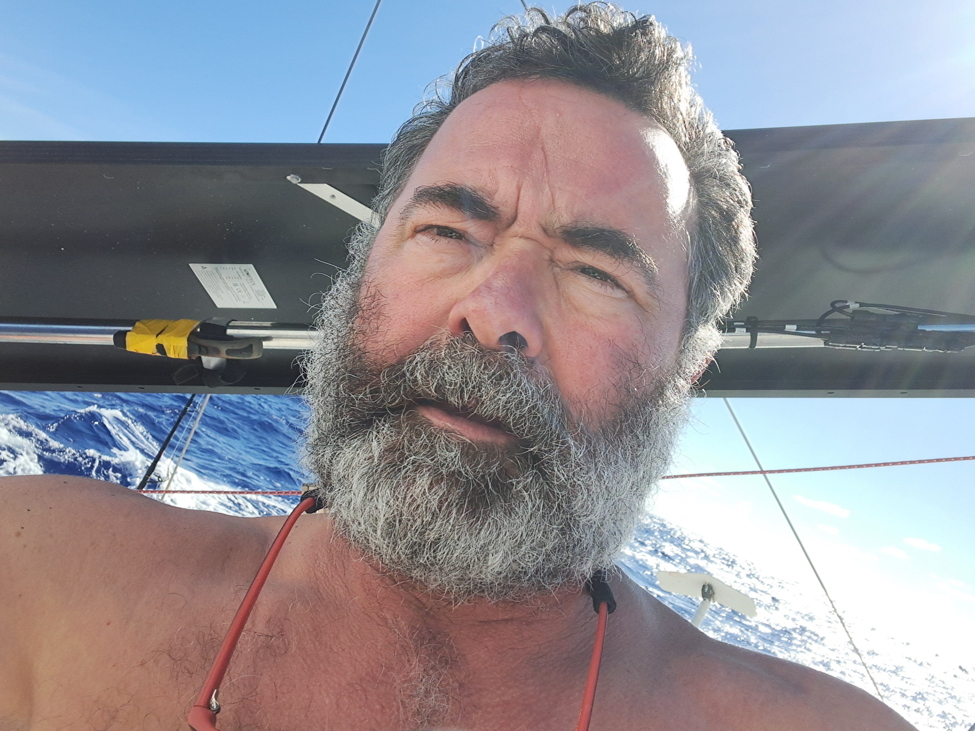 20250312 hirsute